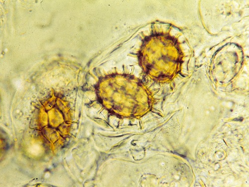 Spores de Tuber Uncinatum v2